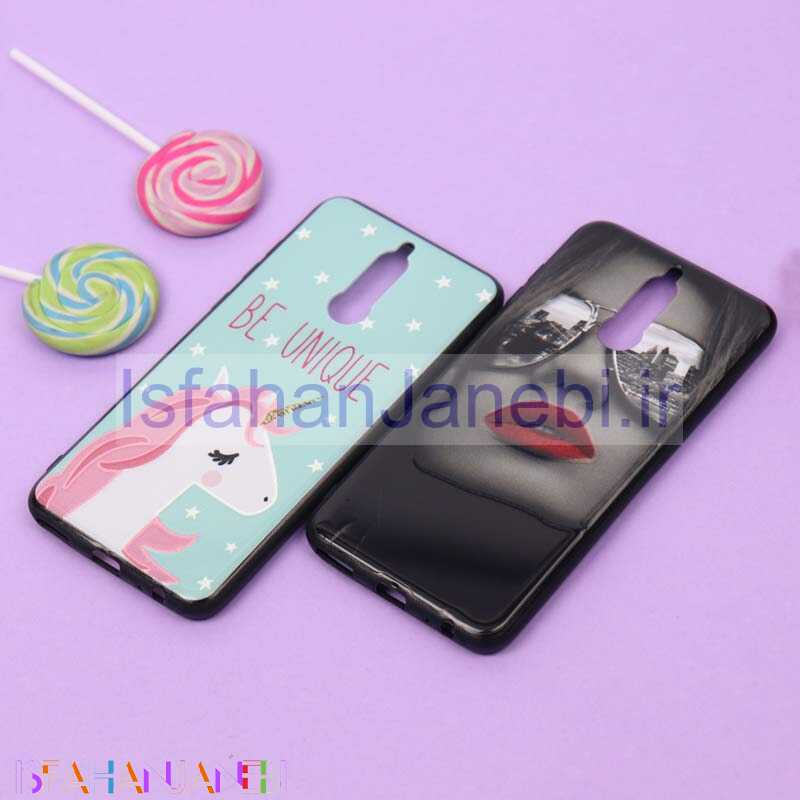 اصفهان جانبی-قاب فانتزی برجسته دخترانه شیائومی Mate 10 Lite سری 2