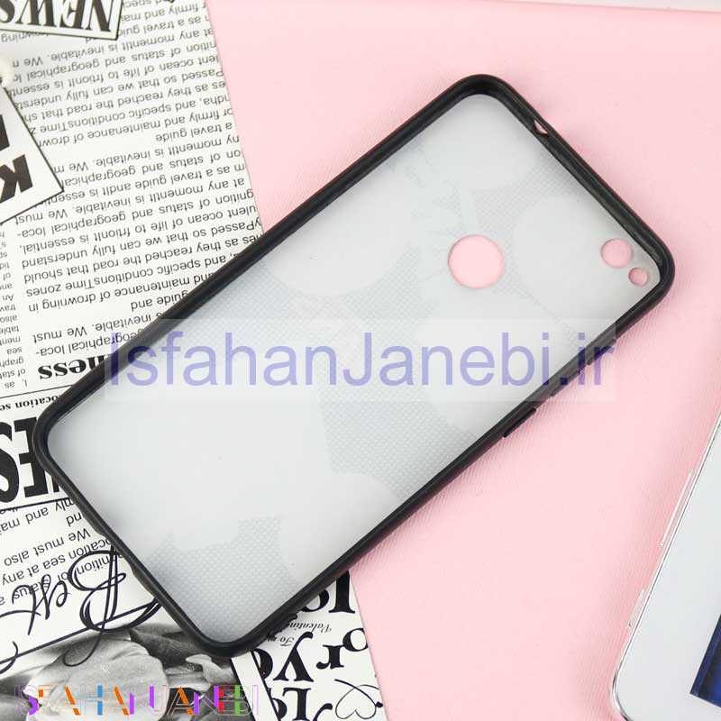 اصفهان جانبی-قاب فانتزی برجسته کد14 هواوی Honor 8 Lite سری E