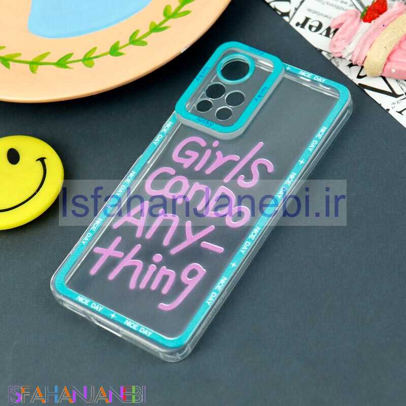 اصفهان جانبی-قاب فانتزی Pro Camera محافظ لنزدار Xiaomi Redmi Note 11 Pro Plus